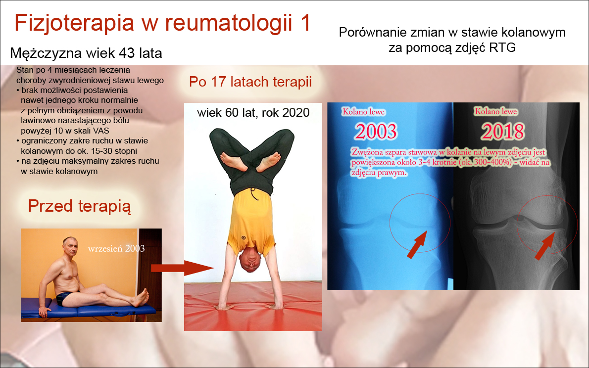 reumatologia 1